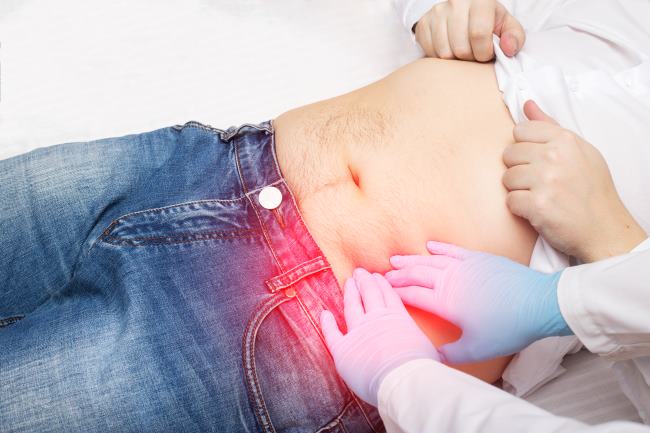 Tumor Usus