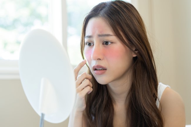 7 Ciri-Ciri Skin Barrier Rusak yang Perlu Diketahui - Alodokter