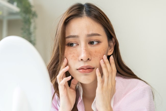 15 Cara Menghilangkan Bintik Hitam di Wajah yang Paling Ampuh - Alodokter