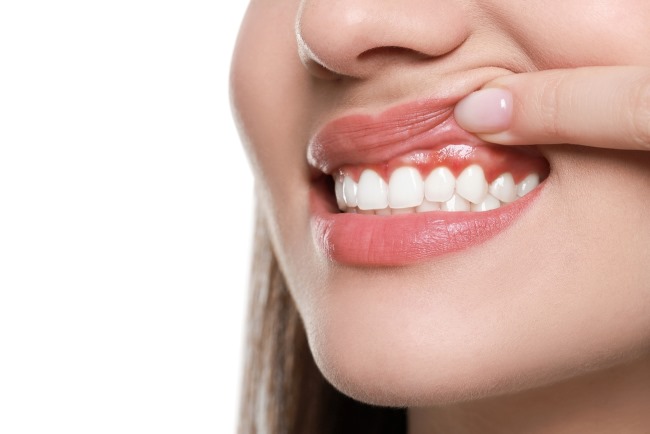 Daging Tumbuh di Gusi, Inilah Berbagai Penyebab dan Penanganannya - Alodokter