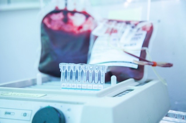 Tes Crossmatch, Ini Tujuan dan Prosedur Pelaksanaannya - Alodokter