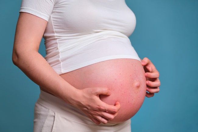 Gatal pada Ibu Hamil Trimester 3, Ini Penyebab dan Tips Mengatasinya - Alodokter