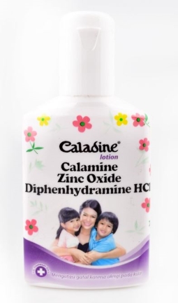 5 Obat Gatal Anak yang Aman dan Efektif - Alodokter