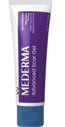 8 Salep Penghilang Bekas Luka yang Menghitam - Alodokter