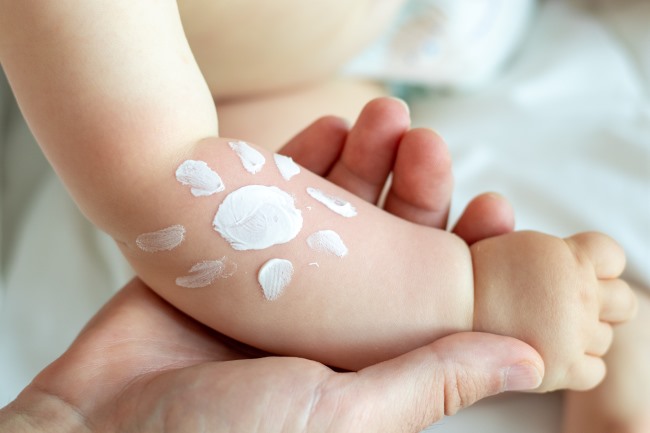 Xeroderma Pigmentosum 