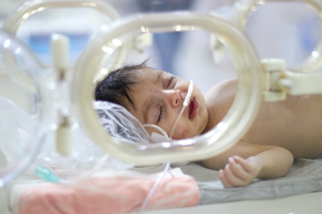 Atresia Duodenum