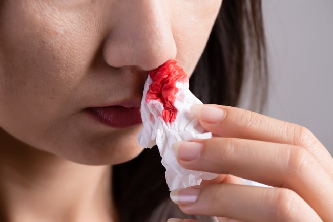 5 Penyebab Mimisan Tiba-tiba pada Remaja dan Cara Mengatasinya - Alodokter