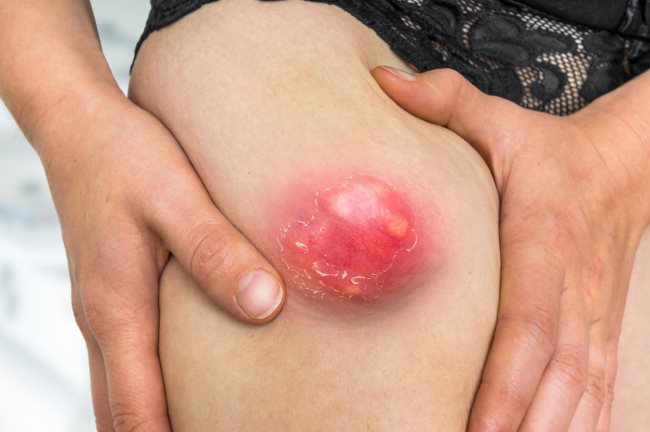 8 Easy Ways to Relieve Stomach Pain Without Medication