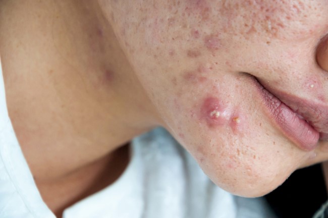 7 Effective Ways to Increase Estrogen Hormone