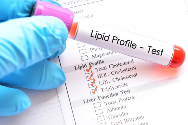 Profil Lipid, Langkah Awal Mencegah Penyakit Jantung dan Stroke - Alodokter