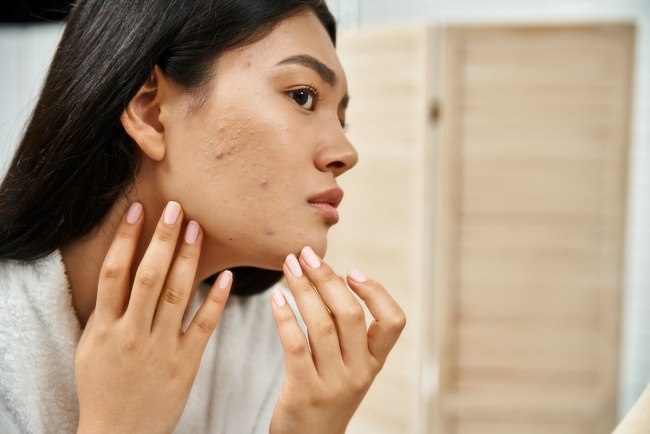 7 Cara Menghilangkan Gradakan di Wajah yang Efektif - Alodokter