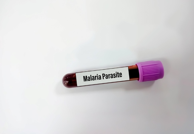 Plasmodium, Parasit Penyebab Malaria yang Perlu Diwaspadai - Alodokter
