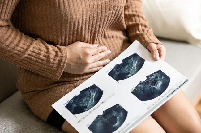 Apakah Kista Bisa Hamil? Ini Faktanya - Alodokter