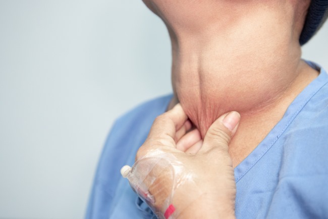 6 Pantangan Tiroid Leher yang Perlu Dihindari agar Cepat Sembuh - Alodokter