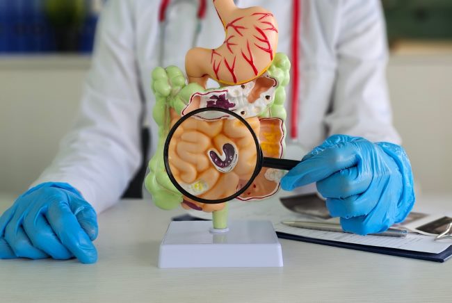 Bagian-Bagian Usus Halus dan Perannya dalam Pencernaan - Alodokter