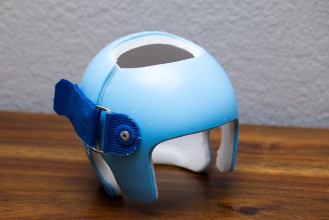 Cranial Helmet, Helm Khusus untuk Kepala Bayi Peyang - Alodokter