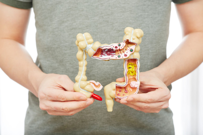 Penyakit Usus Besar, Kenali Gejala, Jenis, dan Cara Mencegahnya - Alodokter