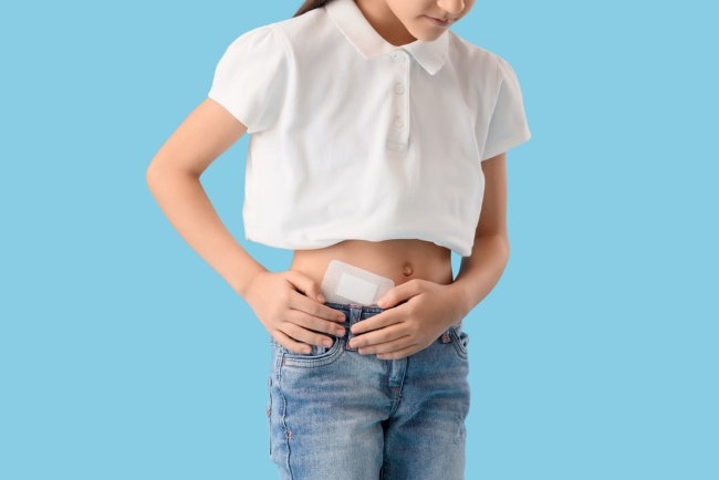 7 Pantangan setelah Operasi Usus Buntu yang Perlu Diketahui - Alodokter