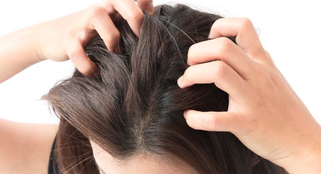 10 Shampoo untuk Kulit Kepala Gatal yang Ampuh - Alodokter