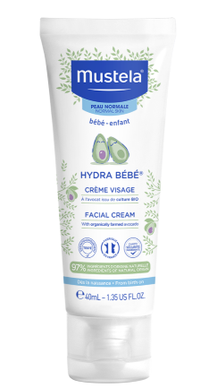 10 Cream untuk Menghilangkan Bintik Merah pada Bayi yang Aman - Alodokter