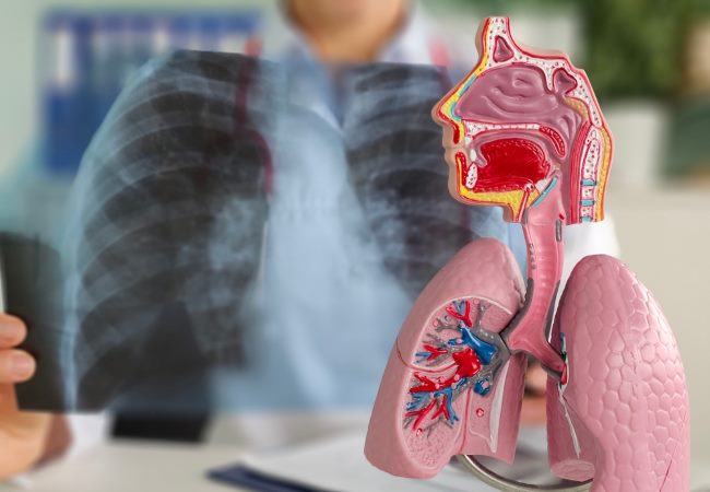 Mengenal Sistem Pernapasan Manusia dan Fungsinya - Alodokter