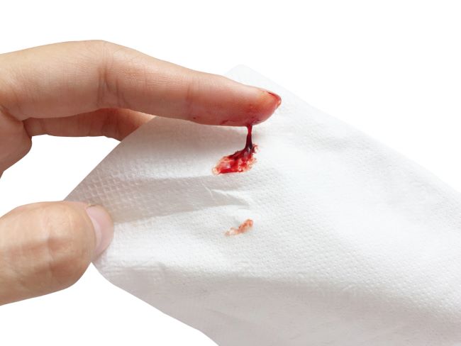 Mengenal Warna Lendir Saat Mau Melahirkan untuk Deteksi Persalinan - Alodokter