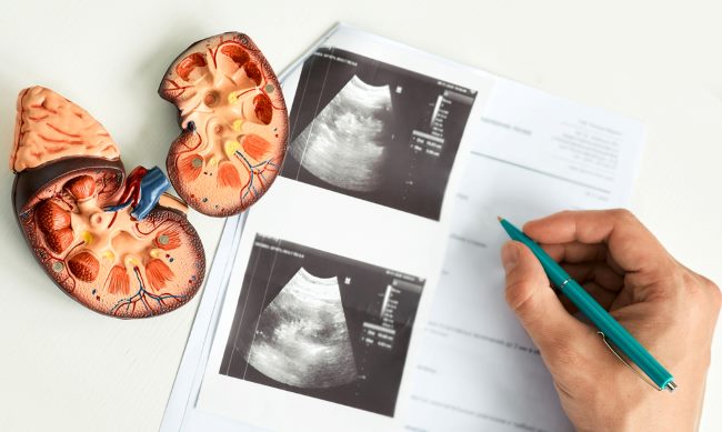 7 Gejala Penyakit Ginjal Stadium Awal yang Sering Diabaikan - Alodokter