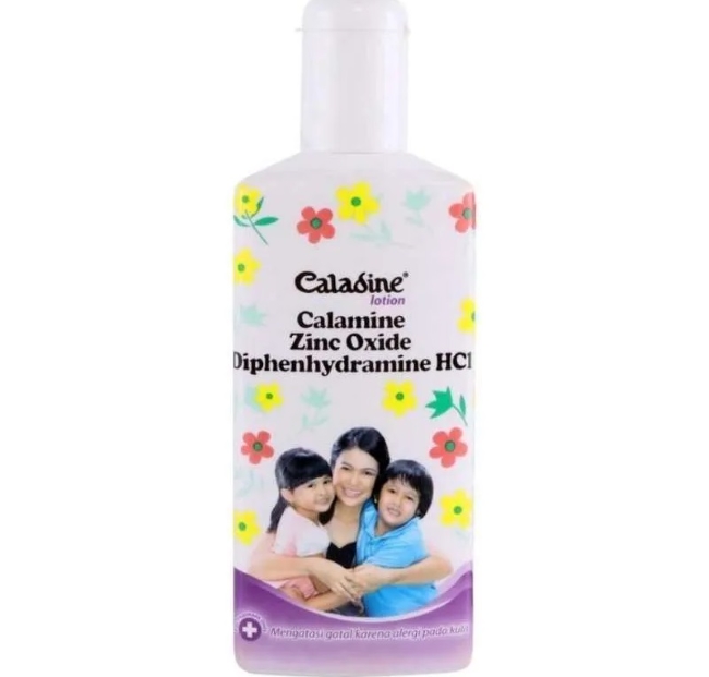 8 Obat Biduran Anak yang Efektif Meredakan Gatal - Alodokter