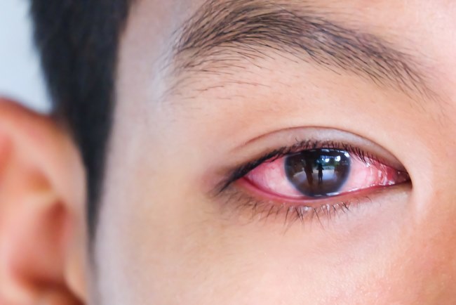 Mata Merah tapi Tidak Sakit dan Gatal, Inilah Penyebab dan Cara Mengatasinya - Alodokter