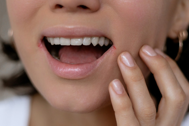 Mulut Terasa Kering Gejala Penyakit Apa? Ini Jawabannya! - Alodokter