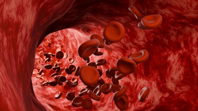 9 Cara Melancarkan Peredaran Darah yang Efektif - Alodokter