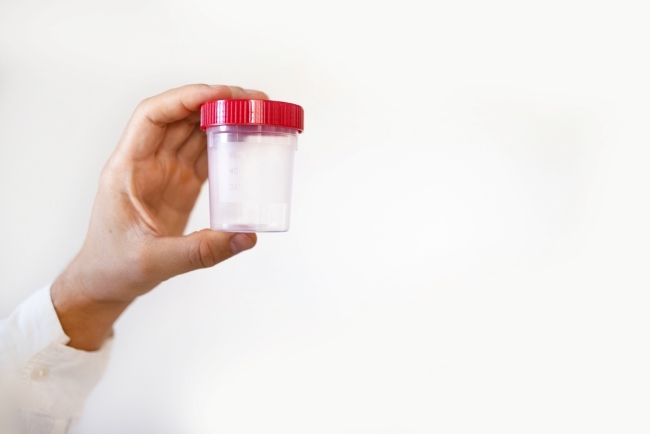 Sperma Menggumpal, Kenali Penyebab dan Pencegahannya - Alodokter