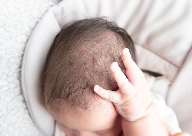 Kepala Bayi Lonjong, Inilah Penyebabnya - Alodokter