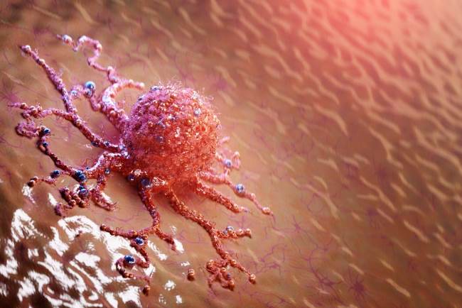 5 Tanda Sel Kanker Mati yang Perlu Diketahui - Alodokter