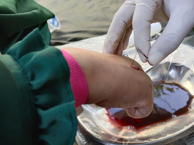 Seputar Terapi Fashdu dan Keamanannya - Alodokter