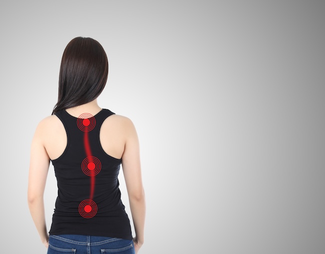 Efikasi Latihan Metode Schroth untuk Adolescent Idiopathic Scoliosis