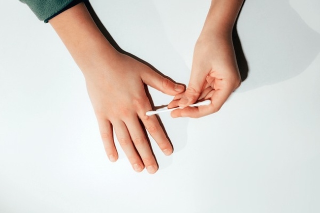 7 Obat Penghilang Kutil yang Aman dan Efektif - Alodokter