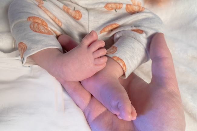 Opsi Penatalaksanaan Nonbedah pada Club Foot