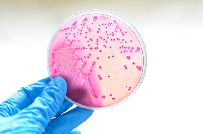 Bakteri, Ini Fakta Penting dan Tips Aman Terhindar dari Infeksi - Alodokter