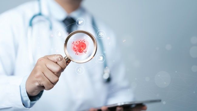 Adenokarsinoma: Gejala, Penyebab, dan Pengobatannya - Alodokter