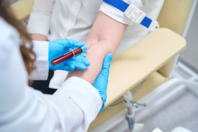 Monosit Rendah, Ini Penyebab dan Penanganannya - Alodokter