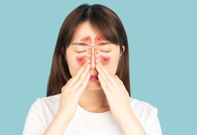 Pedoman Penanganan Sinusitis