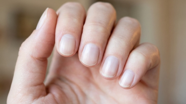 Kuku Pucat, Kenali Penyebab dan Cara Mengatasinya - Alodokter