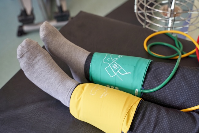 Peningkatan Risiko Penyakit Arteri Perifer pada Infeksi HIV