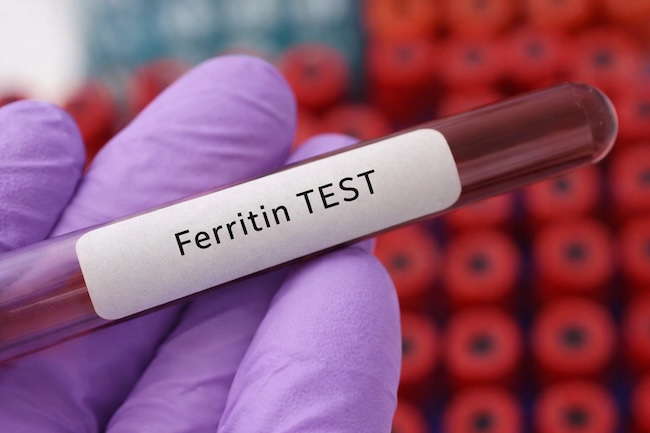 Ferritin Sebagai Prediktor Luaran Demam Dengue