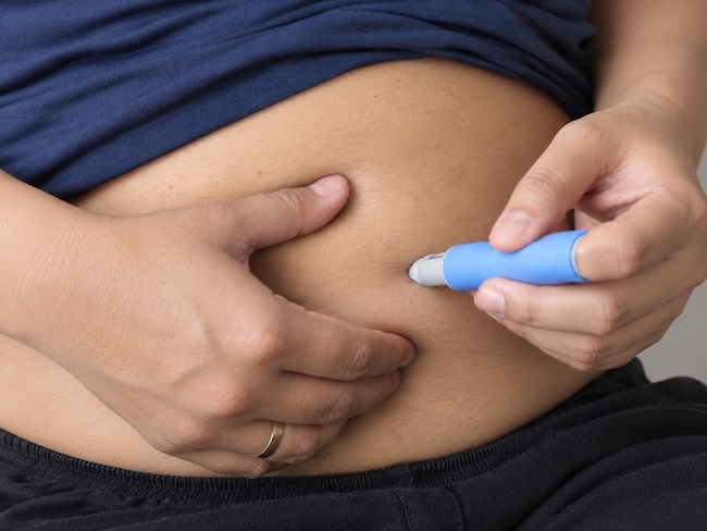 Benarkah Agonis GLP-1 Menurunkan Risiko Kanker Terkait Obesitas Pada Pasien Diabetes