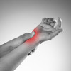 Terapi Fisik Manual Lebih Efektif dibandingkan Pembedahan untuk Carpal Tunnel Syndrome - Telaah Jurnal