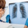 Menelaah Pedoman Nasional Pelayanan Kedokteran (PNPK) Tata Laksana Tuberkulosis 2019