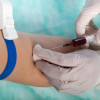 Bahaya Pemeriksaan Laboratorium Darah Rutin Sebelum Tindakan Bedah Elektif Nonkardiak