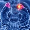 Tumor Adrenal yang Ditemukan Tidak Sengaja pada Pemeriksaan Radiologi